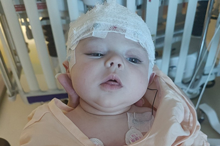 Ellia as a baby with bandages on head after brain cyst surgery