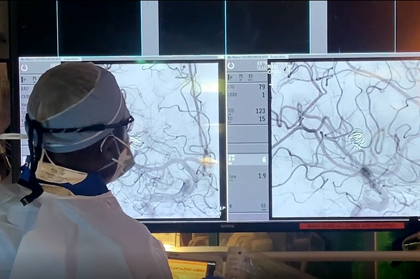 Doctor next to aneurysm image